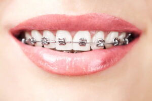 Ortodontie Dej_Ardentis